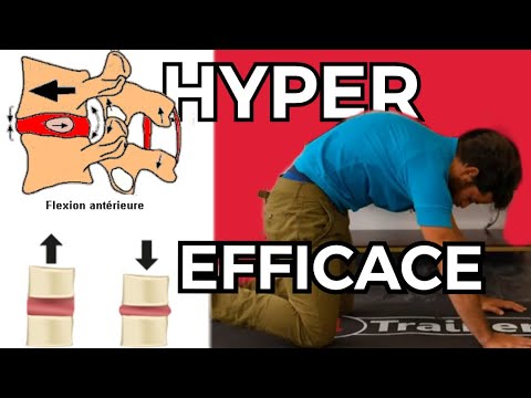 LUMBAGO : Comment soulager un mal de dos aigüe  ?  ( Quick fix #1)